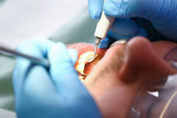 Best Emergency Treatment for Dental Infections or Abscesses in Ashton, ID
