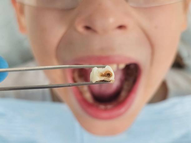 Best Cosmetic Emergency Dentistry in Ashton, ID